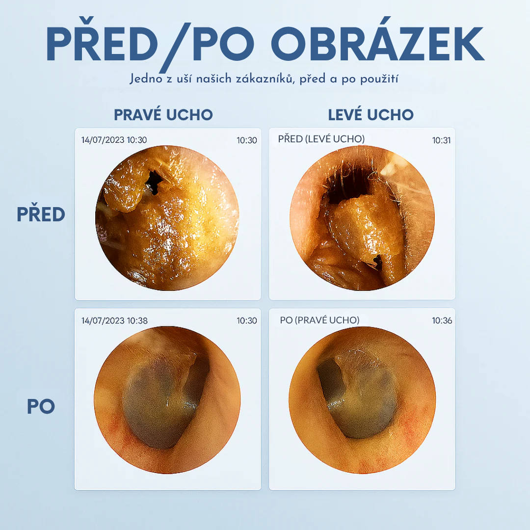WaxAway™ -Chytré čištění uší s pokročilou technologií